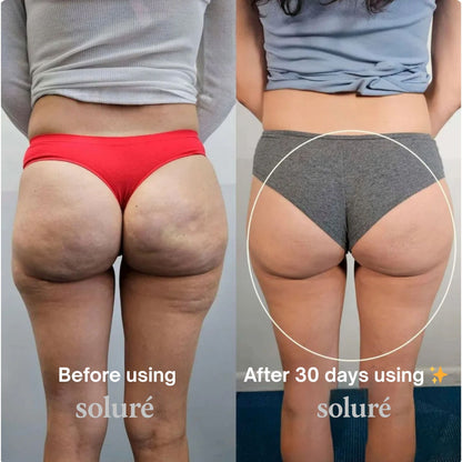 Soluré 4 in 1 RF Sculpt & Slimming Device VERSION 2.0