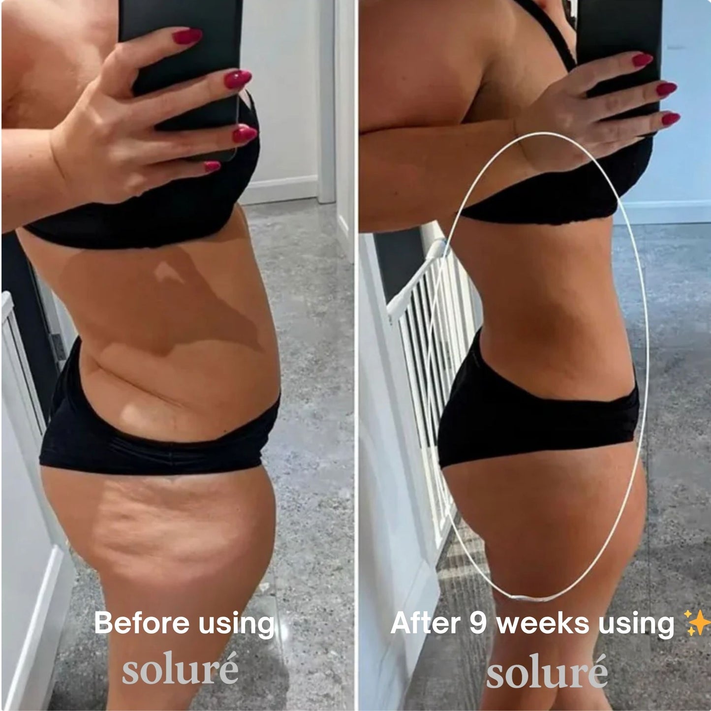 Soluré 4 in 1 RF Sculpt & Slimming Device VERSION 2.0
