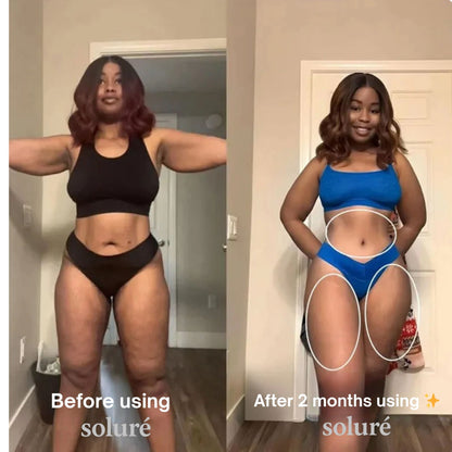 Soluré 4 in 1 RF Sculpt & Slimming Device VERSION 2.0